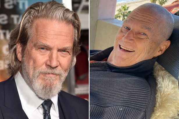 پروسه درمان سرطان جف بریجز به خوبی پیش رفته است